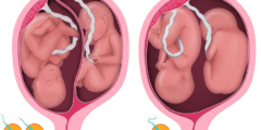 مراحل نمو الجنين التوأم بالأسابيع بالصور هل انت حامل بالتوأم