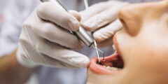 معلومات عن طبيب الأسنان من هو ما هي مهام  طبيب الأسنان