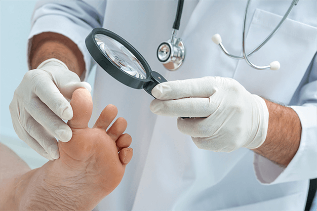 علاج فطريات القدم بين الأصابع
